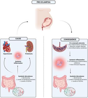 An altered gut microbiome in pre-eclampsia: cause or consequence